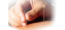 Agopuntura e Massaggio